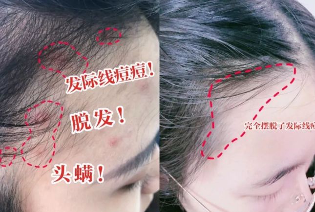 是吹干好？10分钟轻松养成女明星「绸缎发」mg不朽情缘游戏登录入口洗完头自然风干还(图15)